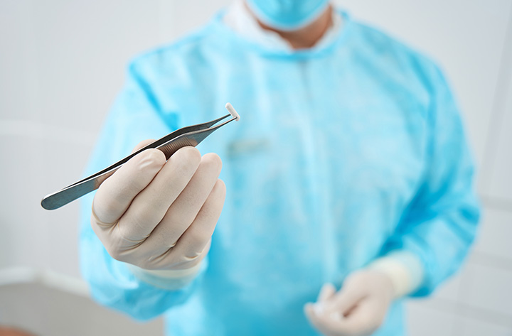 pellet therapy